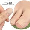 Parche para el cuidado de las uñas, incrustación de surco para uñas, almohadilla para dedos largos, pegatinas ortopédicas, pegatinas para uñas grises suaves