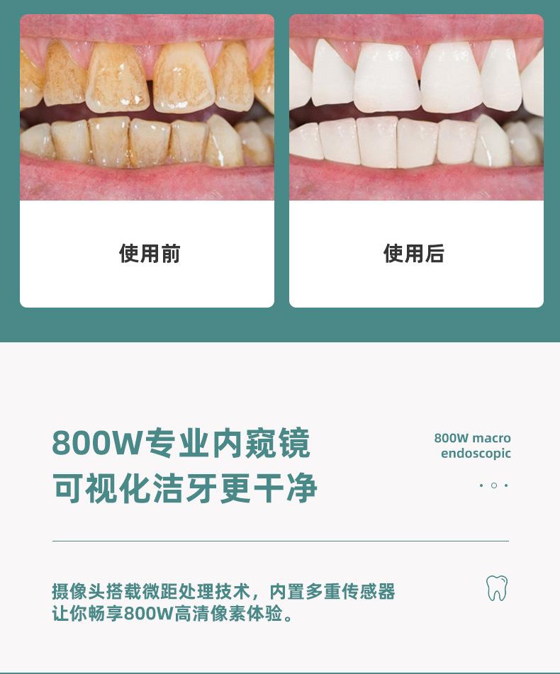 可视洁牙仪_09