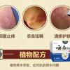 Ungüento Yunnan Fungus Wang Shake Tone con Crema Antipruriginosa Antibacteriana para Uso Externo Fábrica de Origen Venta al por Mayor