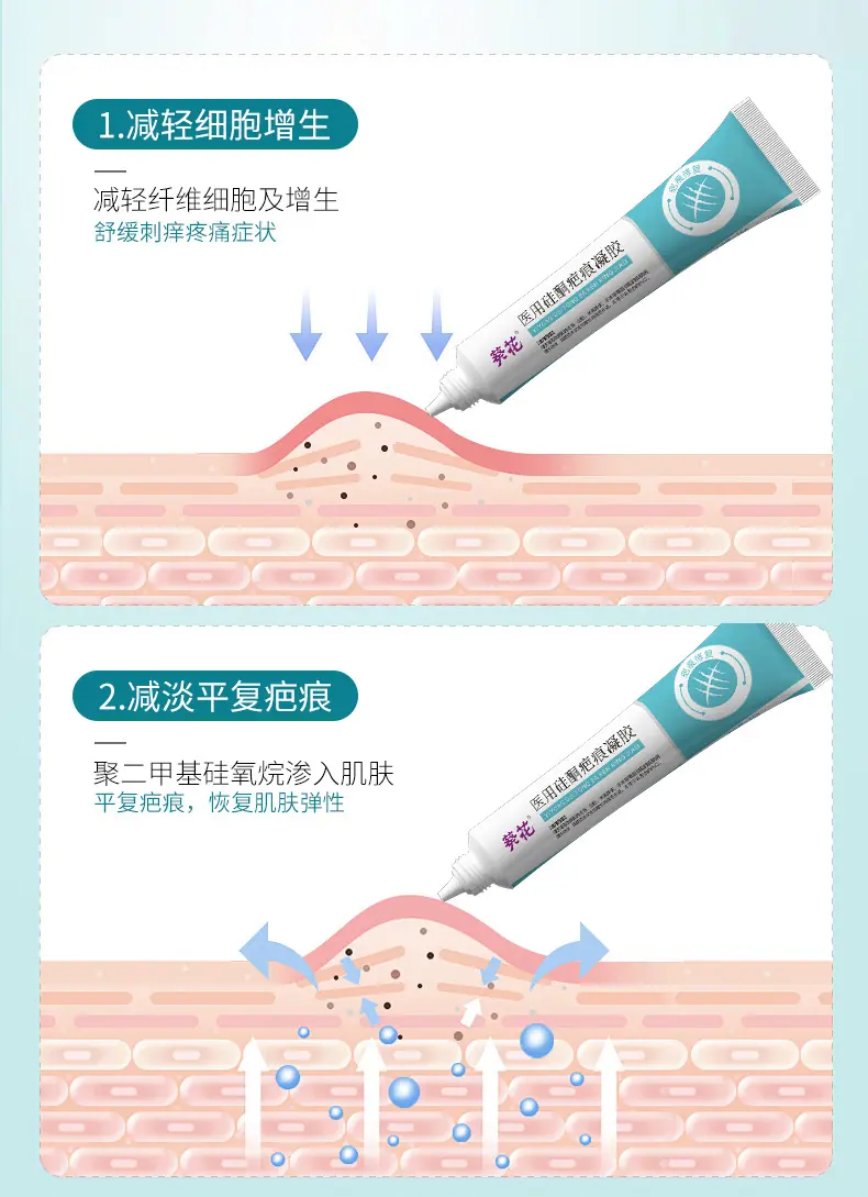 医用硅酮疤痕凝胶详情11