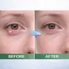 Suero Transfronterizo 30ml Empaque Neutro Sérum para Ojos Stye