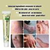 Sumifun Crema Herbal Transfronteriza Ungüento Crema para Tiña Crema para Uso Externo para la Piel Cuidado de la Piel Crema para la Salud K10328