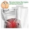 Pomada para Cuidados com Hemorroidas Ximonth para Desconforto Anal, para Reduzir Crescimentos de Carne e Aliviar Hemorroidas, Uso Externo