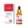 Líquido Antibacteriano Teyi Skin é Adequado para Amarelamento, Espessamento, Separação Irregular da Leito Ungueal, Alívio e Reparo de Onicomicose