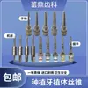 Implante dental implante dental macho de roscar división ósea extrusión ósea expansión ósea incremento óseo Denten Ao Diente Tai general