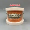 Modelo ortodôntico dental modelo autoligante de cermet oral display de comunicação médico-paciente ambulatorial modelo dental de ensino