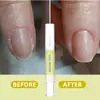 Aceite para el Cuidado del Borde de la Uña Lunoon Transfronterizo Suave Nutritivo Anti-Padrastros Cuidado de la Piel Muerta 3ml