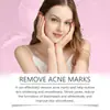 Crema Facial para el Acné South Moon Repara el Acné Facial, Cierra Poros, Nutre la Piel, Suaviza Crema para el Cuidado de la Piel