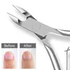 Tijeras para Cutícula de Manicura para Eliminar Piel Muerta, Cutículas y Padrastros, Tijeras de Reparación Avanzadas, Herramientas de Cuidado para Uñas de Acero Inoxidable
