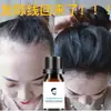 Sérum para Crecimiento de la Línea del Cabello, Sérum para el Crecimiento del Cabello, Alarga Rápidamente el Cabello Corto, Previene la Caída del Cabello, Sérum para el Crecimiento y Fortalecimiento del Cabello, Aceite Esencial para el Crecimiento y Cuidado del Cabello