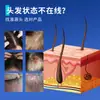 Zou Run'An Shikang Wang Champú de Ketoconazol Limpia Folículos Pilosos Aceite del Cuero Cabelludo Ácaros Caspa Musgo en la Cabeza Refrescante Loción Antibacteriana