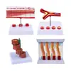 Boyou Modelo Vascular Modelo Médico Simula Modelo de Vaso Sanguíneo Humano Bloqueio de Vaso Sanguíneo Treinamento de Vaso Sanguíneo