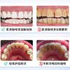 Pasta de Dientes Blanqueadora Genuina Renhe Que Elimina las Manchas de Tabaco Es la Pasta de Dientes Probiótica Número Uno Más Vendida Que Refresca, Elimina las Manchas Amarillas, Elimina el Mal Aliento y Blanquea los Dientes