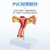 Modelo de útero femenino médico modelo de estructura reproductiva ovárica modelo de anatomía ginecológica Obstetricia y Ginecología modelo de ovario y útero
