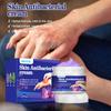 ERAYCEE Crema Antiprurítica para la Piel de Viola viride a Base de Hierbas Transfronterizas No Irritante Uso Externo Picaduras de Mosquito Crema de Uso Externo