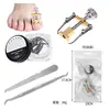Corrector de inserción de uñas Amazon Nail Groove, hebilla para uñas, bobina para uñas, alicates para corrección de uñas, juego de parches para uñas
