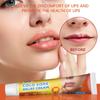 Sumifun Crema para el Cuidado Externo de los Labios Ungüento Externo Amazon Coupang Shopee Aliexpress Comercio Exterior Transfronterizo K10212