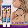 Hbesty Crema para Eliminar Verrugas Transfronteriza, Manchas de Verrugas en la Piel, Lunares, Callos, Crema para el Cuidado sin Marcas