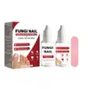 Conjunto Popular Transfronteiriço de Solução Antifúngica Solução Reparadora 15ml *2