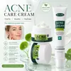 Crema para el Acné con Ácido Salicílico Transfronteriza Crema Facial para el Acné Desvanece Marcas de Acné, Crema para el Acné, Crema Control de Grasa, Inglés Completo