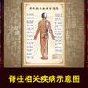 . Medicina Tradicional China moxibustión acupuntura mapa de puntos del cuerpo mapa de puntos de meridianos del cuerpo póster grande mapa de meridianos HD hogar completo