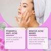 Mes del Oeste Crema Acondicionadora con Ácido Azelaico Cuidado de Limpieza Suave Crema Refrescante y Cómoda