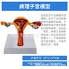 Modelo anatómico patológico del útero reproductor femenino humano. Modelo didáctico del ovario vaginal. Material didáctico sobre reproducción ginecológica.
