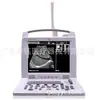 Exportação de comércio exterior máquina de ultrassom B portátil Scanner de ultrassom portátil totalmente digital