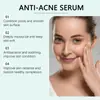 Esencia para el Cuidado de la Piel Ouhoe Limpieza Suave Piel Facial Acné Espinilla Suavizante Esencia para la Piel