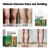 Crema Nutritiva para Piernas Transfronteriza Sin Marca para Aliviar Venas Varicosas y Reparar Crema de Masaje para Cuidado de Uso Externo 100g