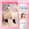 Creme branqueador para pele das axilas transfronteiriço partes sensíveis escurecimento creme hidratante clareador área triangular partes íntimas clareador White