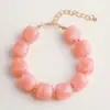 Pulsera de Cuentas de Contraste de Color Exagerado de Moda para Verano en Colores Dulces Dopamina, Pulsera Versátil de Estilo Vacacional para Mujeres