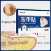 Parches para Uñas Estilo Guangdong al por Mayor para Engrosar Surcos de Uñas, Tratar Onicomicosis, Callosidades, Durezas y Uñas Encarnadas, Parches de Cuidado, Transmisión en Vivo, En Stock