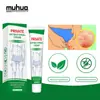 Aliexpress Lazada Crema Alivio de Picazón 20g Crema Cuidado Pomada Piel Uso Tópico Salud Íntima Cuidado Personal
