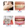 Spray para Cálculo Dentário, Mau Hálito, Cálculo Dentário, Placa Bacteriana, Manchas de Fumaça, Placa Bacteriana, Manchas de Chá, Venda por Atacado de Fábrica, Dropshipping