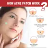 Ouhoe Cuidado Facial Parche para Acné Limpieza Suave Piel con Acné Suave y Lisa Múltiples Formas Parche para Acné Portátil