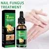 Solución Transfronteriza de 7 Días para Reparación de Uñas con Esencia de Jengibre para Reparar Uñas Grises, Nutrir el Perímetro de las Uñas y Proporcionar Cuidado General para Manos y Pies, 30 ml