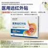 Marca OEM Enteritis Crónica, Gastritis, Dolor Abdominal, Hinchazón, Diarrea, Parche Gastrointestinal Médico de Rayos Infrarrojos Lejanos, Parche de Yeso para Enteritis