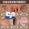 Ungüento Yunnan Fungus Wang Shake Tone con Crema Antipruriginosa Antibacteriana para Uso Externo Fábrica de Origen Venta al por Mayor