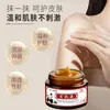 Alívio de Alergia para Coceira e Inchaço na Pele Roll-On Creme de Massagem Oem Feito Sob Medida Pomada Calmante para Alergias de Pele, Vermelhidão e Manchas com Coceira