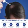 Producto Caliente Certificado Ndc Transfronterizo Personalizado Minoxidil al 5% Cuidado del Cabello Líquido para el Crecimiento del Cabello Líquido para Cabello Denso Esencia para el Cuero Cabelludo