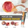 Pomada Sumifun para Úlceras por Presión Hidrata y Protege la Barrera Cutánea para Personas Postradas en Cama, Nuevo Producto Transfronterizo