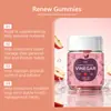 Las gomitas revitalizantes de vinagre de manzana ayudan a mantener una postura corporal cómoda y ligera, complementan nutrientes y asisten en el control de peso.