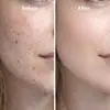 Suero de Péptido de Cobre Azul Transfronterizo 30ml GHK-Cu Líquido Original Esencia Facial Reparadora Reafirmante e Hidratante