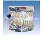6岁标准乳牙模型医学模型