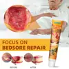 Sumifun Ungüento para Úlceras por Presión de Veneno de Abeja Aliexpress Amazon Transfronterizo Cuidado de Úlceras por Presión Salud del Anciano K10244