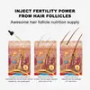 Aceite Esencial de Jengibre para el Cuidado del Cabello Transfronterizo Solución Nutritiva Aceite de Jengibre Esencia de Cuidado para Espesar el Cabello 30ml