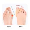 Órtesis para hallux valgus de doble anillo, diaria, SEBS, cuidado de los dedos, protección para los pies, funda para los pies, superposición de pies, corrección de la separación de los dedos.