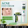 Crema para el Acné con Ácido Salicílico Transfronteriza Crema Facial para el Acné Desvanece Marcas de Acné, Crema para el Acné, Crema Control de Grasa, Inglés Completo