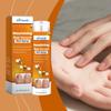Spray Nutritivo para Uñas Ximonth Cuidado Suave, Limpieza, Cuidado de Manos y Pies, Fortalecimiento de la Superficie de las Uñas, Hidratación y Suavizado de Cutículas